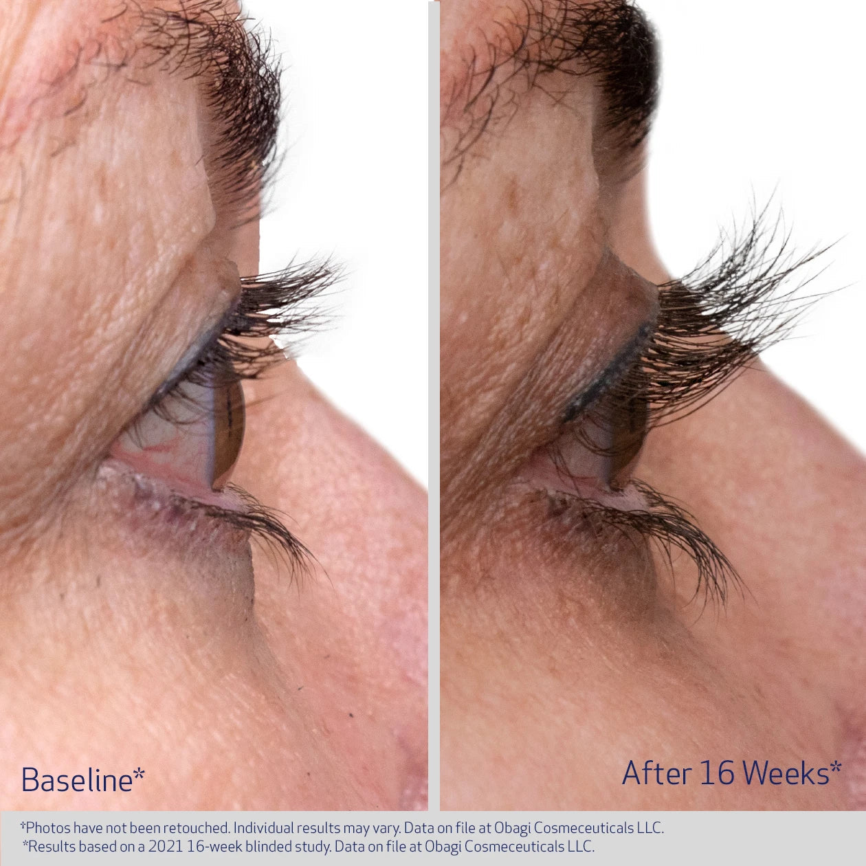 Obagi® Nu-Cil™ EYELASH ENHANCING SERUM