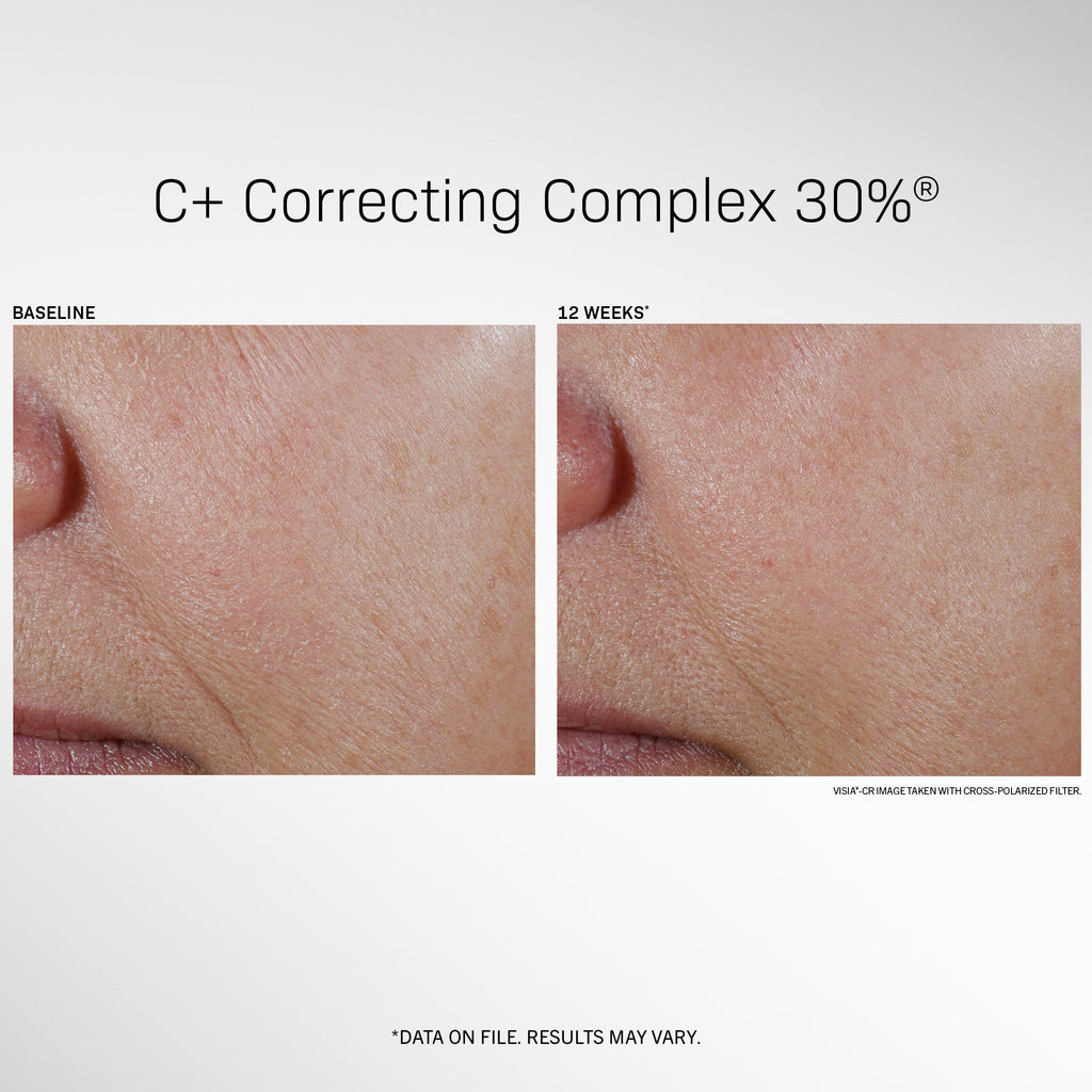 Revision® C+ Correcting Complex 30%® -1 fl oz.